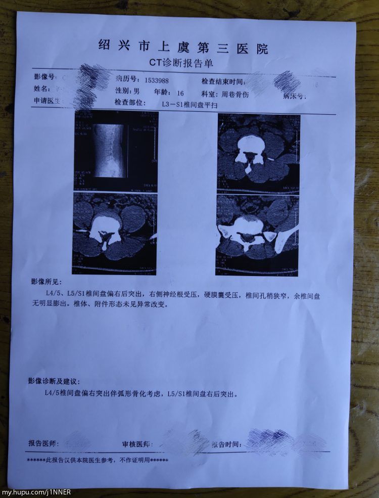 拿到ct检查单的我有点迷茫,17岁,腰间盘突出.