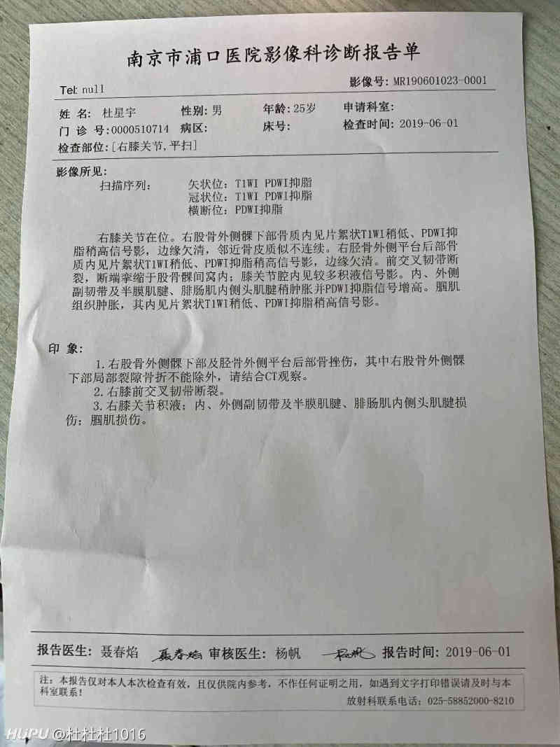 看核磁共振,感觉很严重啊,好像半月板和骨头也有点问题,主要还是交叉