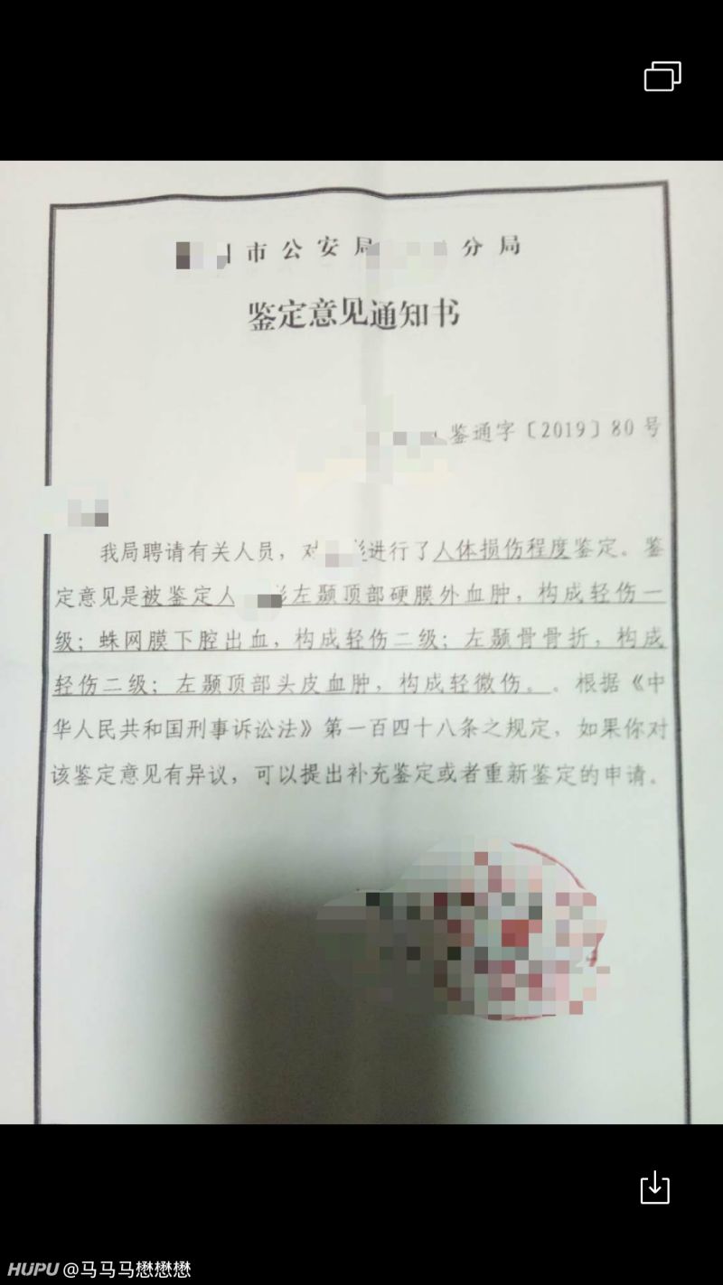有懂伤残鉴定的jrs吗