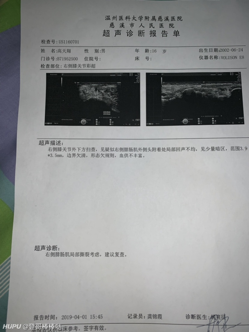 腓肠肌局部撕裂