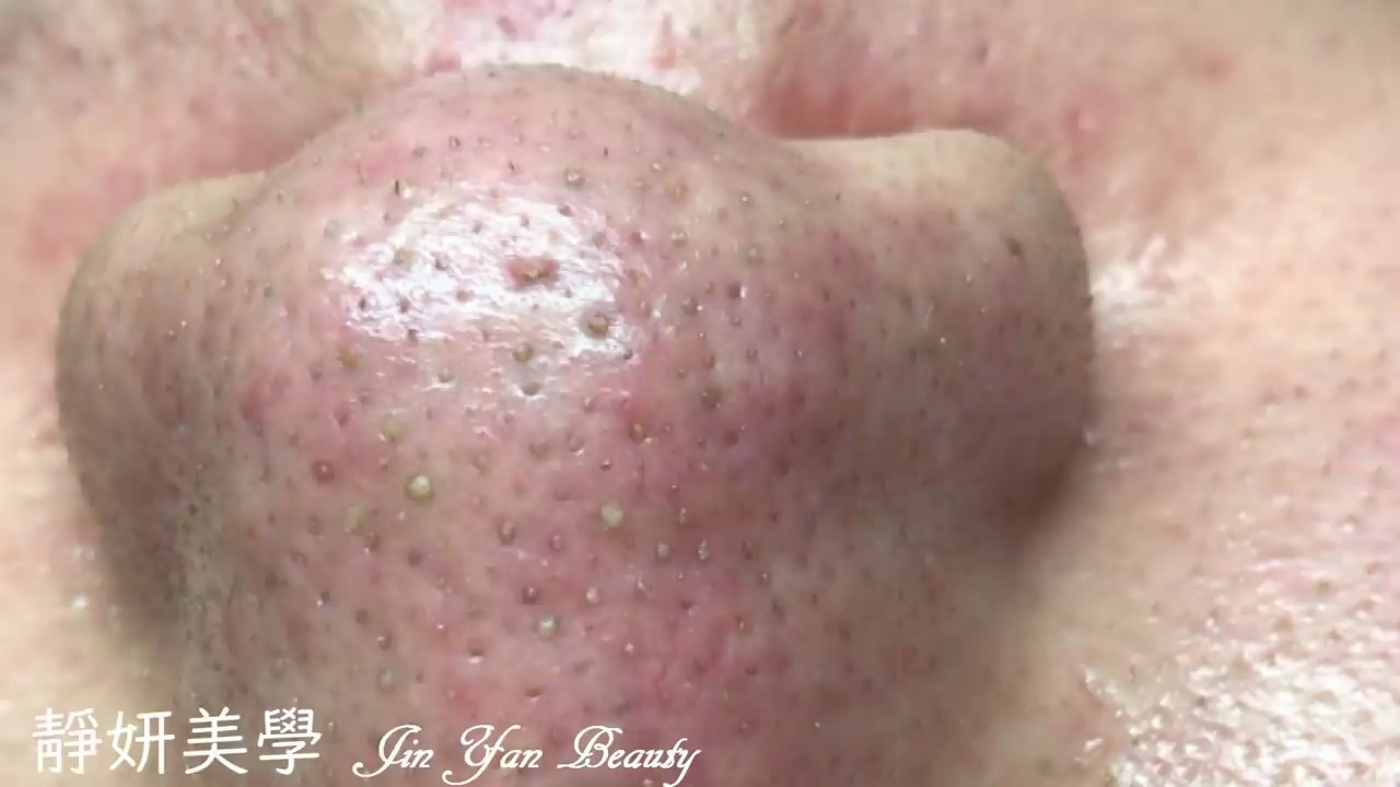 video-poster