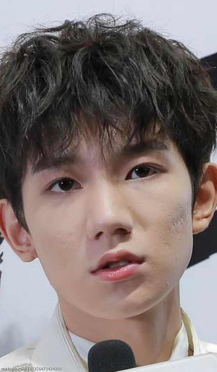 王源的脸这是怎么了?
