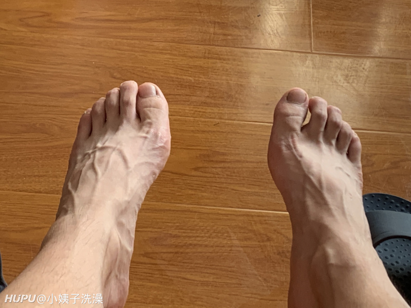 各位看下我脚上的青筋正常吗 足控请进 虎扑
