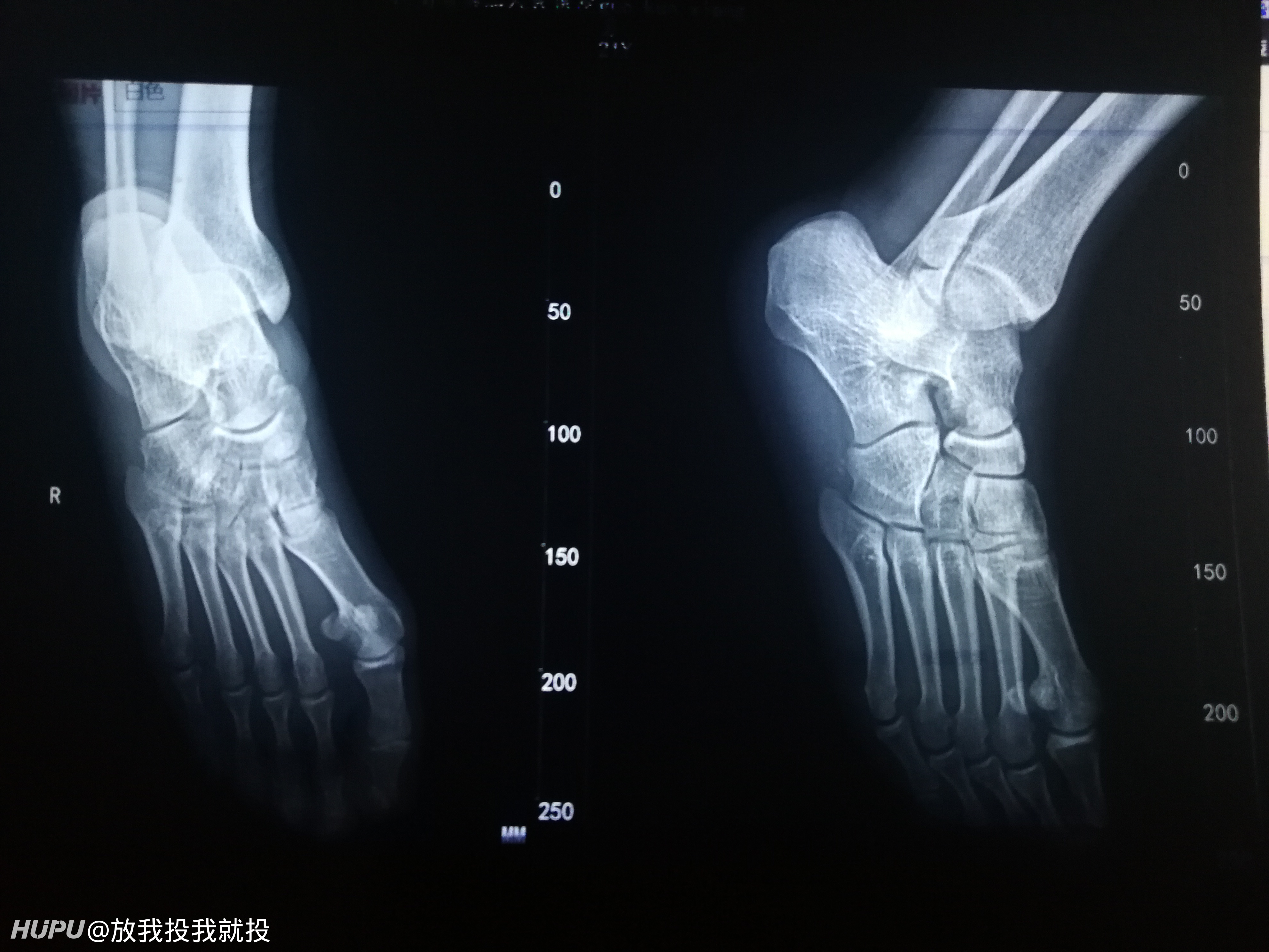 终于轮到我了 我是运动康复专家 大家有什么想问的 19年5月日虎扑存档 看帖神器 终于轮到我了 我是运动康复专家 大家有什么想问的 19年5月日虎扑存档 看帖神器