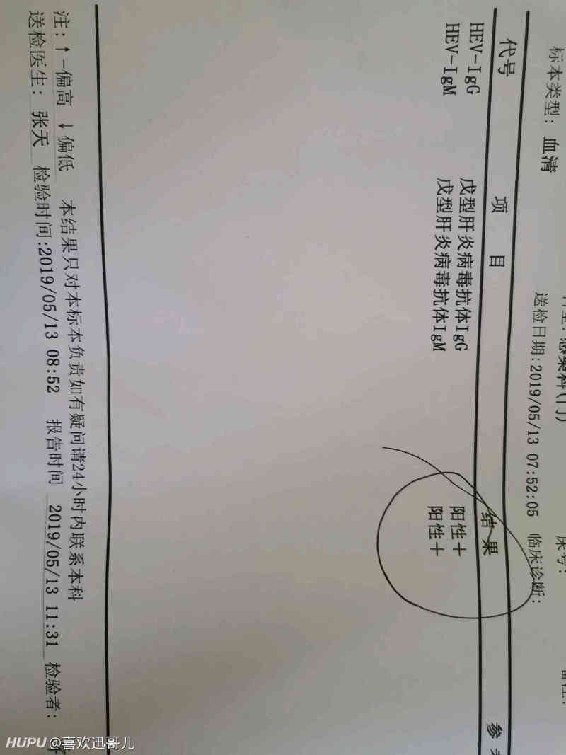 去年做手术查出来有戊肝,小弟不才,考进中行,笔面顺利通过,到了体检