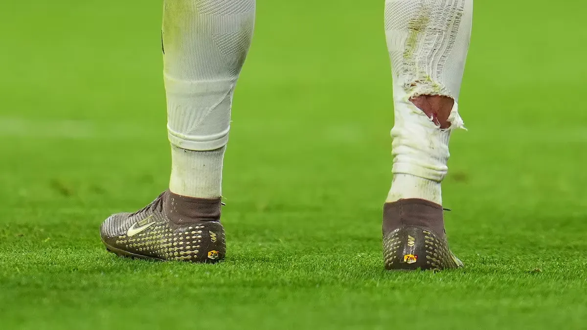 [流言板]球袜被直接踢破！姆巴