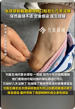 女孩新鞋磨脚创口贴几天没换致感染